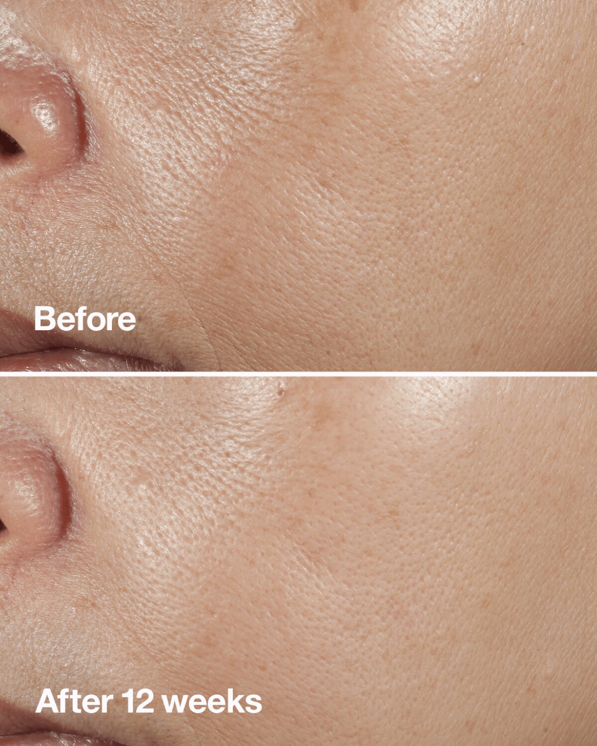 Before. After 10 days. After 16 weeks.